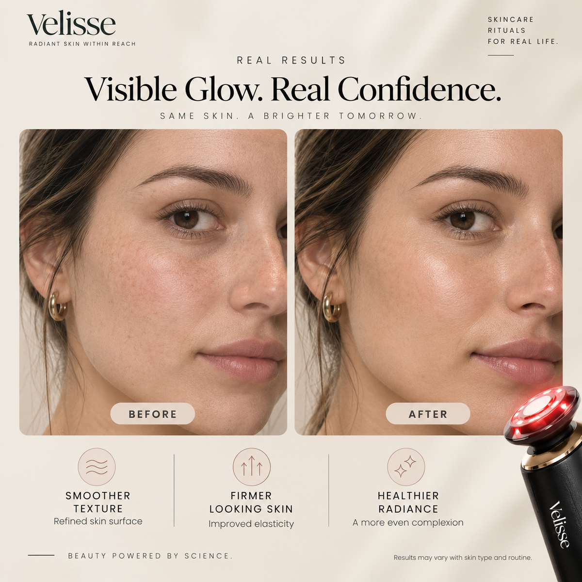 Velisse — Red Light Therapy Skincare Massager