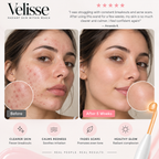 Velisse — High Frequency Wand