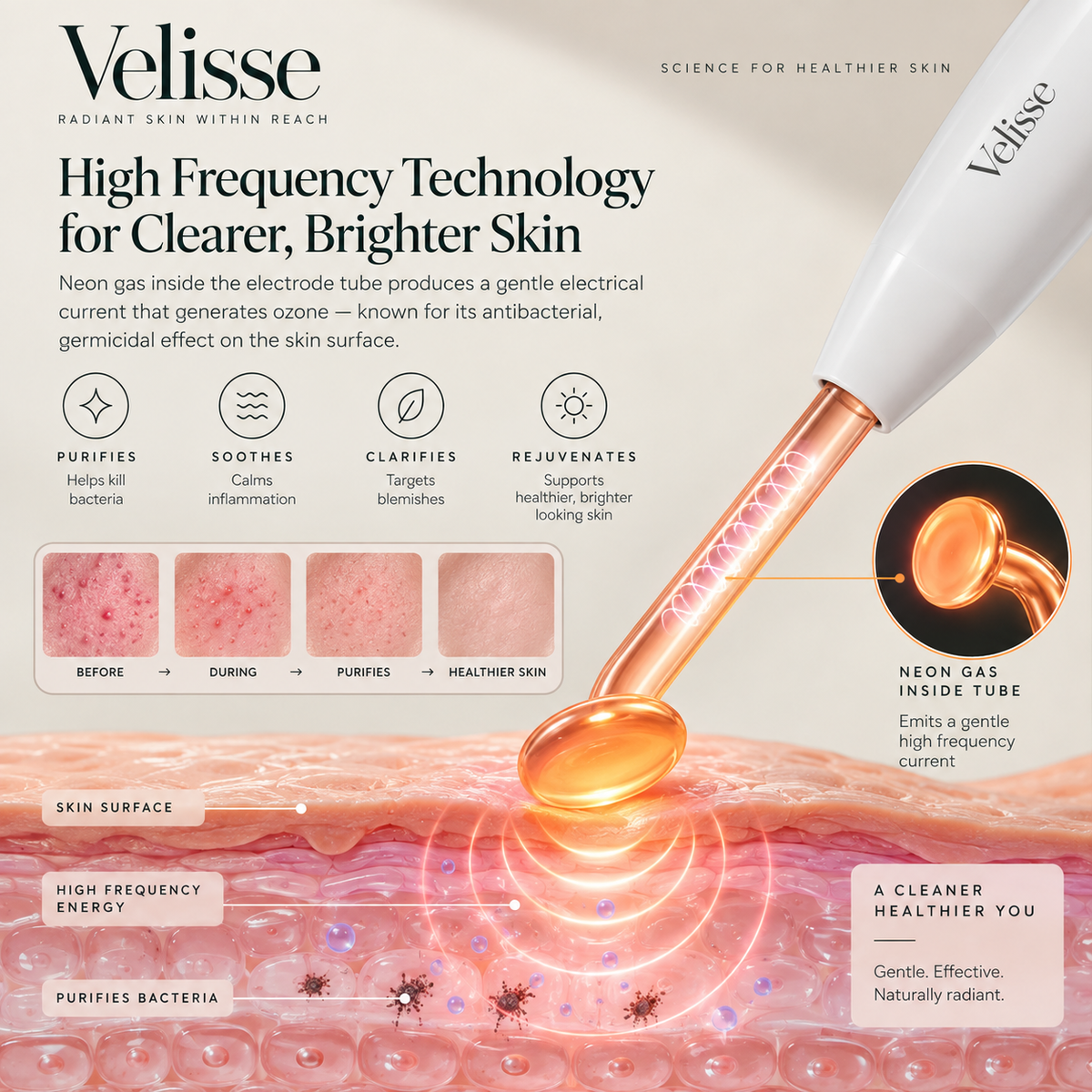 Velisse — High Frequency Wand